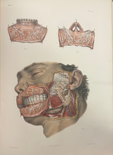 Portada de Trait� Complet de L'Anatomie de L'Homme comprenant L'Anatomie Chirurgicale et La M�decine Op�ratoire. Tomo V. Appareil de Nutrition. Splanchnologie  - Bourgery et Claude Bernard