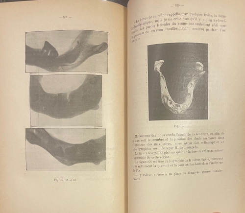 Portada de L'Art Dentaire en Medecine Legale - Oscar Amo�do