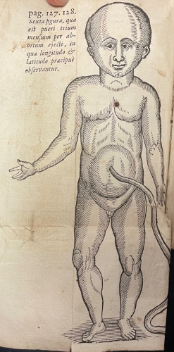 Portada de De Integritatis et Corruptionis Virginum Notis. Enneas Muliebris. De Origine Partium. De Septo Cordis Pervio. De Notis Virginitatis - Severin Pineau. Ludovico Bonaccioli. Felix Platter. Pierre Gasendi. Melchor Sebisch