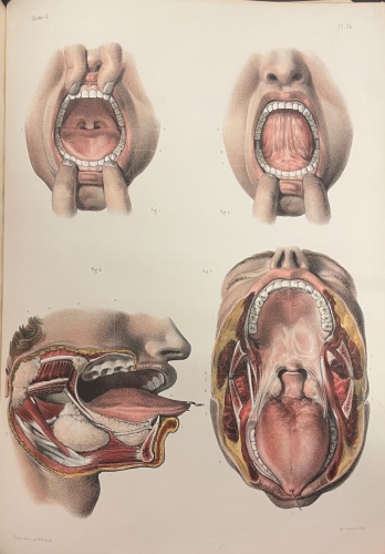 Portada de Trait� Complet de L'Anatomie de L'Homme comprenant L'Anatomie Chirurgicale et La M�decine Op�ratoire. Tomo V. Appareil de Nutrition. Splanchnologie  - Bourgery et Claude Bernard