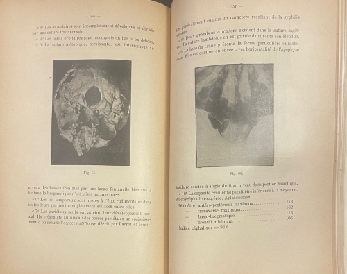 Portada de L'Art Dentaire en Medecine Legale - Oscar Amo�do