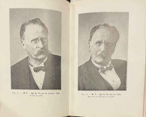 Portada de �tude sur la Vieillesse et le Rajeunissement par la Greffe. El Injerto Animal. Sus ventajosas aplicaciones a la ganader�a - Serge Voronoff