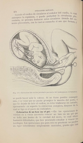 Portada de Tratado Completo de Obstetricia - F. de P. Campa