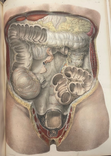 Portada de Trait� Complet de L'Anatomie de L'Homme comprenant L'Anatomie Chirurgicale et La M�decine Op�ratoire. Tomo V. Appareil de Nutrition. Splanchnologie  - Bourgery et Claude Bernard