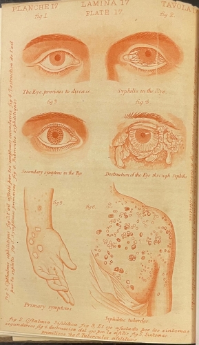 Portada de El Discreto Amigo. Tratado pr�ctico de anatom�a y Fisiologia de los �rganos generadores y de sus enfermedades.. - R. y L. Perry y Compa��a