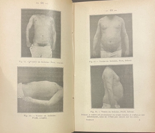 Portada de Techinique de L'Exploration Clinique du Tube Digestif - Georges Guenaux