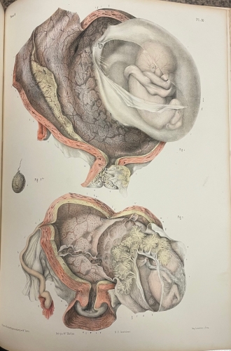 Portada de Trait� Complet de L'Anatomie de L'Homme comprenant L'Anatomie Chirurgicale et La M�decine Op�ratoire. Tomo VIII. Embryog�nie  - Bourgery et Claude Bernard